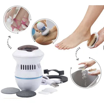 Quita callos: solución perfecta para que tus pies estén más suaves y sin dolor.